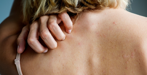 Why is My Skin So Sensitive & Itchy During Menopause?