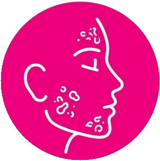 Hormonally-influenced breakouts