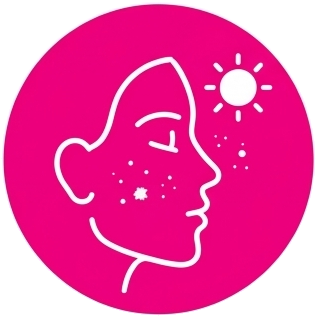 Dull skin and loss of radiance